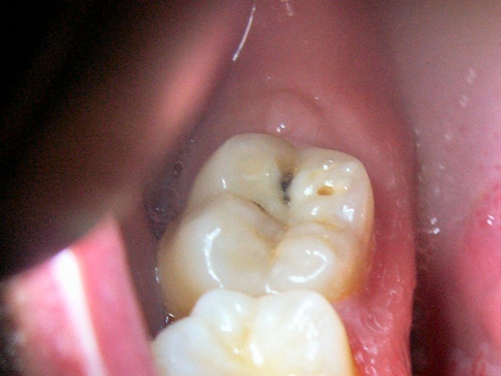 cavity problem