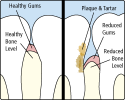 Periodontist in Schaumburg